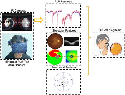 Binocular head-mounted chromatic pupillometry can detect structural and functional loss in glaucoma